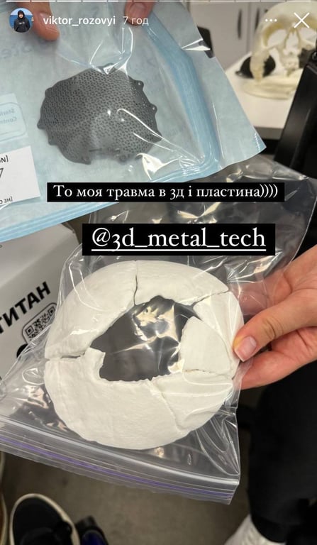 Виктор Розовый, как готовился к операции. Фото: instagram/viktor_rozovyi