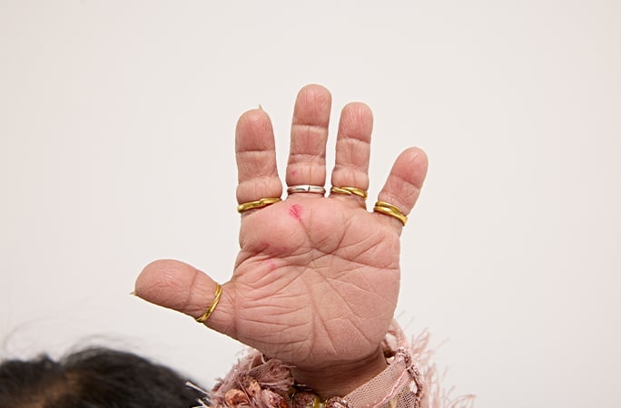 Найменші у світі руки