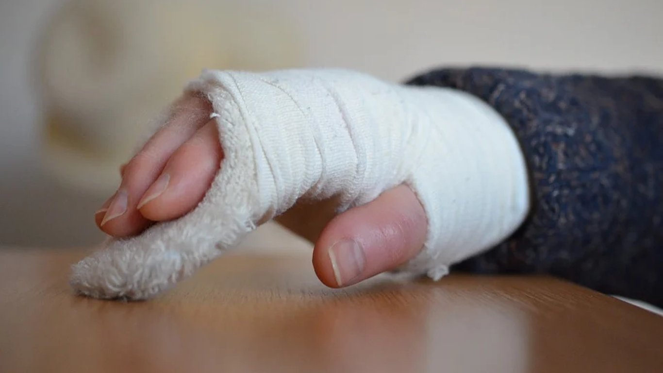 Из больницы выписали 10-летнюю девочку, которая пострадала в ДТП на Львовщине
