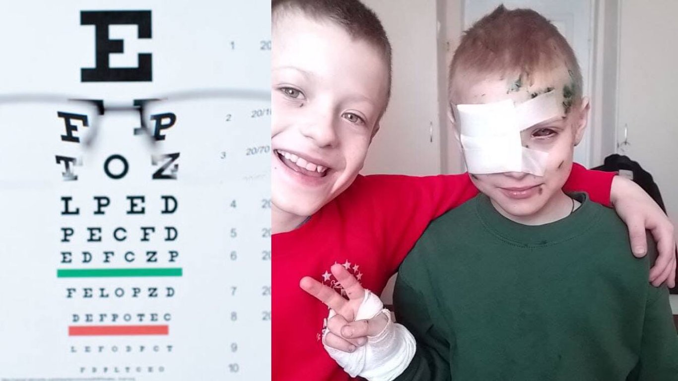 Війна в Україні - допомоги потребує 9-річний хлопчик, вибухова хвиля вибила йому око