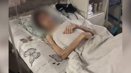 В Одессе подростка, которого отец заморил голодом, вернут в семью: что известно - 285x160