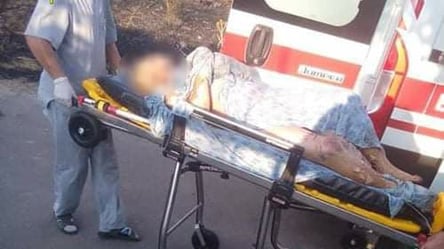 Порушила закон - потрапила в лікарню: на Миколаївщині літня жінка отримала тяжкі опіки поки палила сміття - 285x160