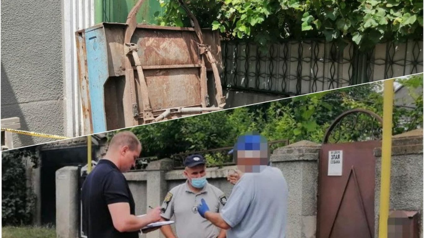 В Одесской области соседский алабай покалечил двухлетнего мальчика